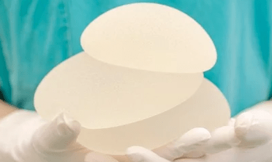 Implants mammaires pour l'augmentation mammaire